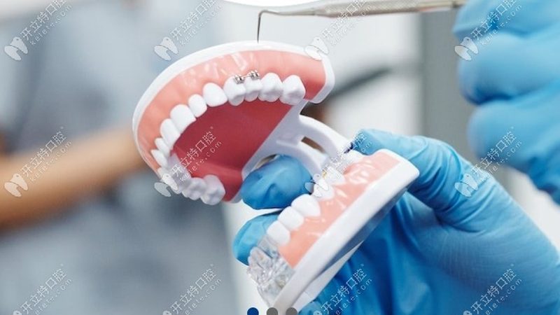 全口种植牙术后，如何做好口腔清洁护理？**