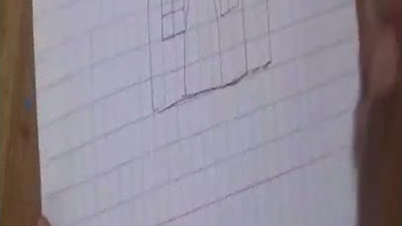 贴面修复，如何辨识其规格参数？**