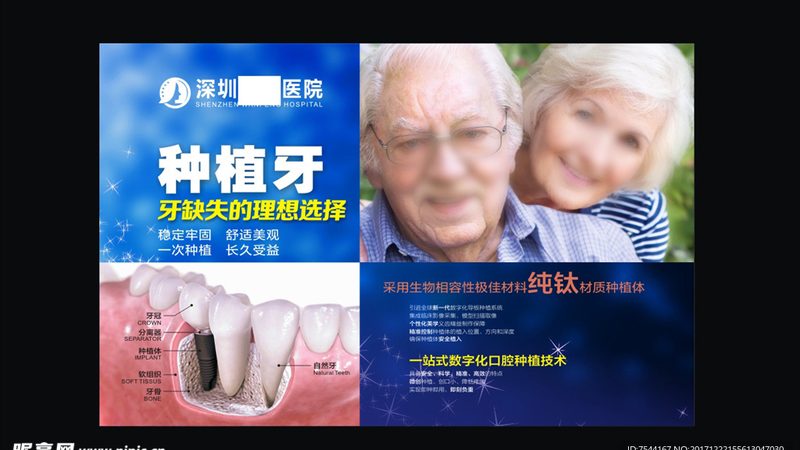 根管治疗急诊，上海哪家医院更专业？**